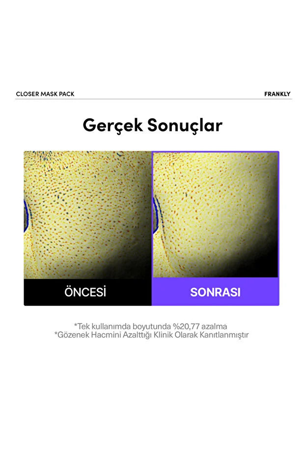 Frankly Closer Pore Minimizing Mask Pack 22 ml - 1 stuk