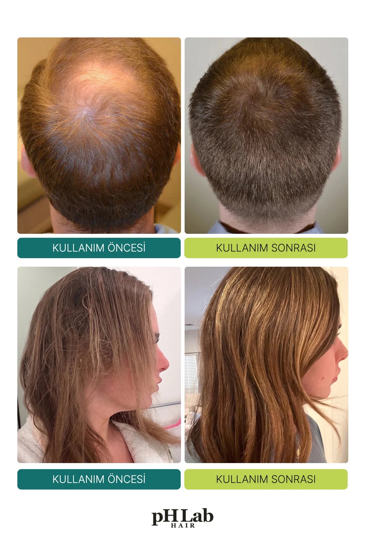 pH Lab Hair 88/4 Micro Spicule Scalp Shot – Exosome, NAD+ 6000 PPM & Triple PDRN Hoofdhuidverzorging